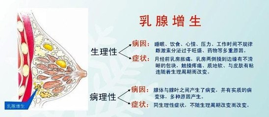 乳腺增生的发病原因是什么呢